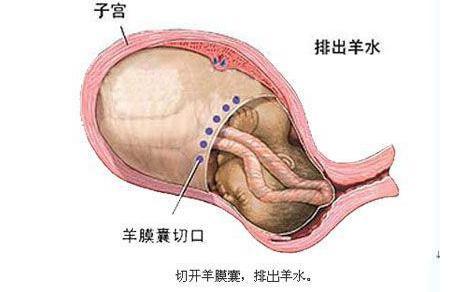 期間產後惡露正可預示產後子宮恢復好與壞