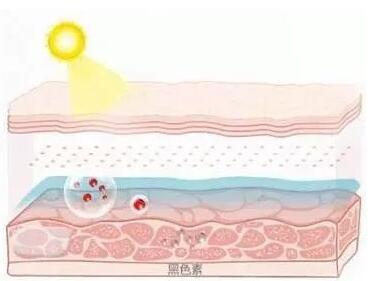 三个淡斑选择抑制黑色素生成促进黑色素排出再穷也要买