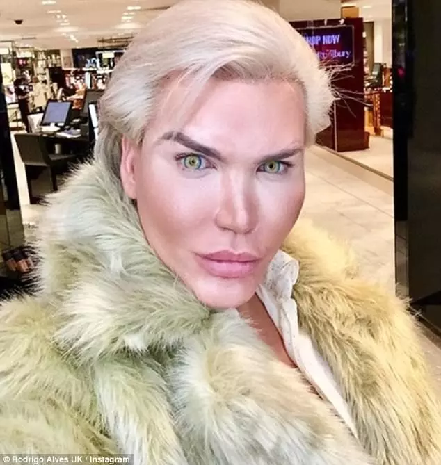 巴西整容狂人为减肥在胃里装气囊脸部变形严重网友称不忍直视