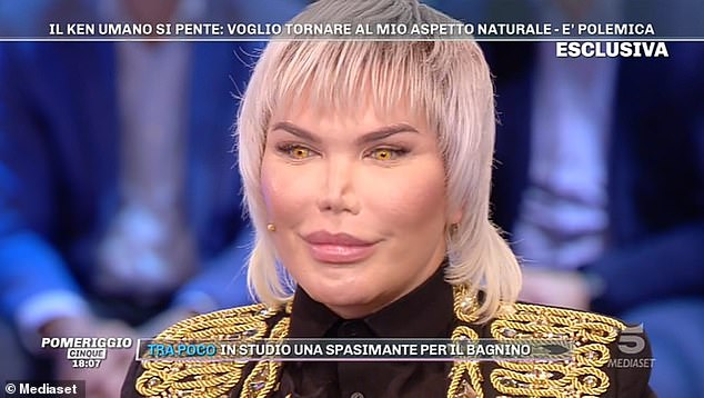 巴西整容狂人为减肥在胃里装气囊脸部变形严重网友称不忍直视