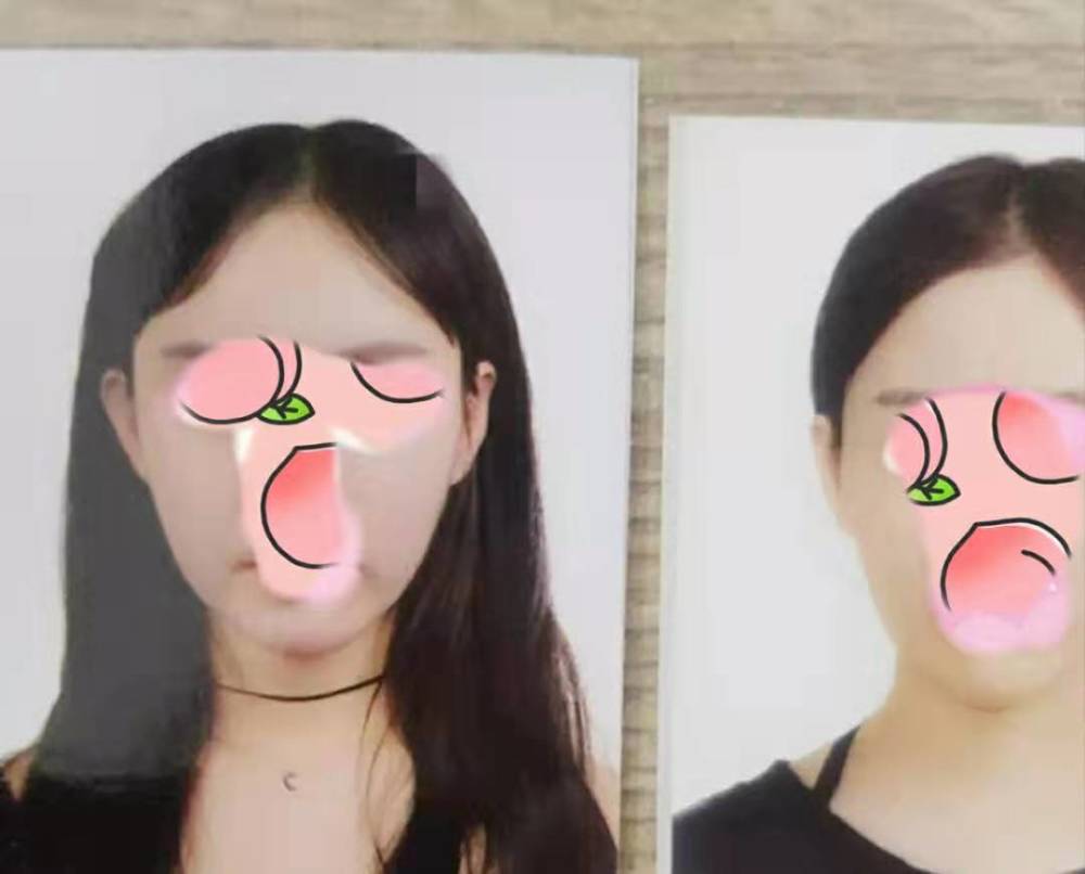 中国女孩韩国整形失败 互联网医美平台要背负多少责任 腾讯新闻