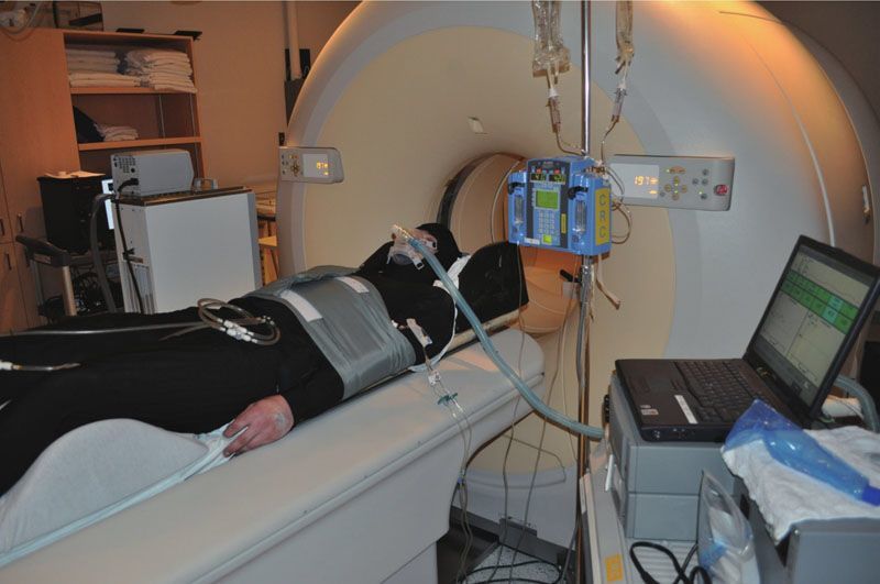 超低温冷疗走进冷冻室的娱乐明星