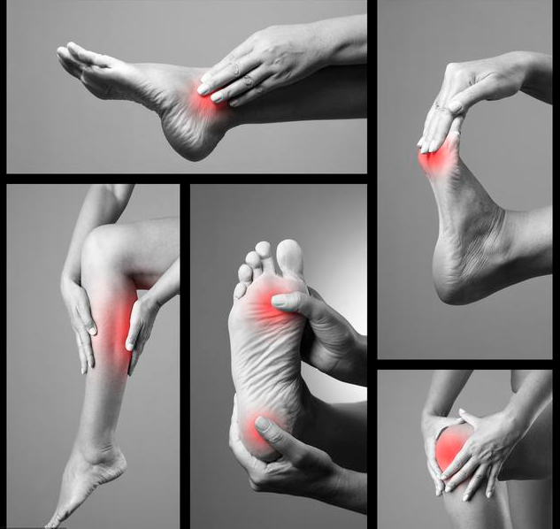 最常见的就是跖骨处,也就是大母脚趾,通常是首发位置,其次会出现在