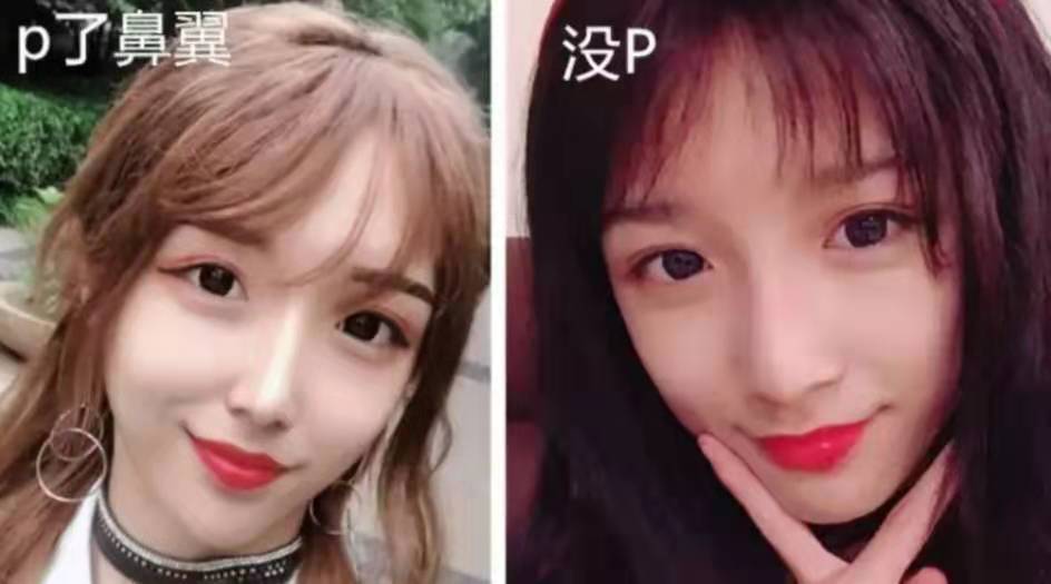 先看看艾比整容前的美照吧,可盐可甜的很受欢迎.