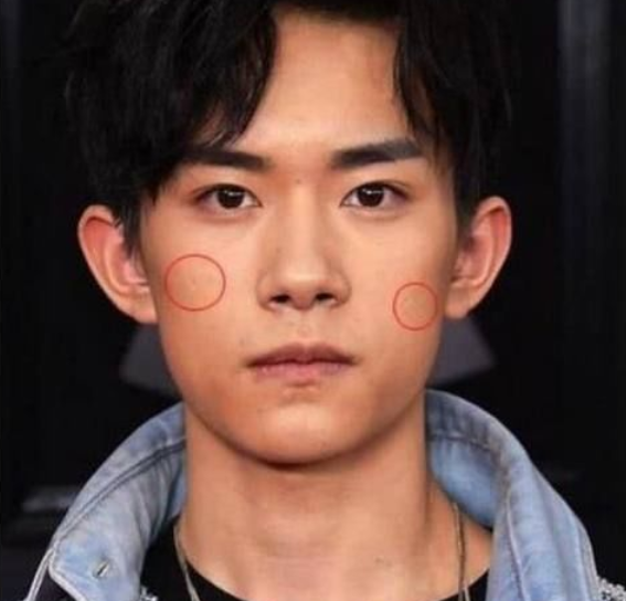 4位明星脸上的疤痕,易烊千玺打架,杨幂爬树,而他最让人心疼!