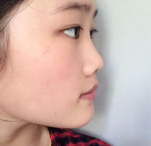 "蒜头鼻"影响颜值?3招变成好看"水滴鼻",还怕男神见了不会宠?