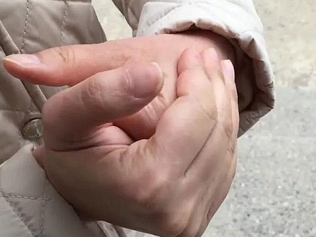 掰手指"咔咔响"是好是坏?很多人认为很帅,但不知有这几种危害