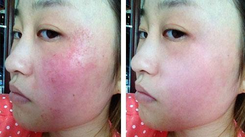 重度敏感?四招教你修复受损肌肤,皮肤光滑细腻有光泽