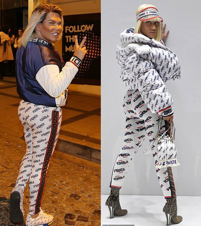 巴西男芭比迎来第75次手术,创吉尼斯纪录,自称智力超常人