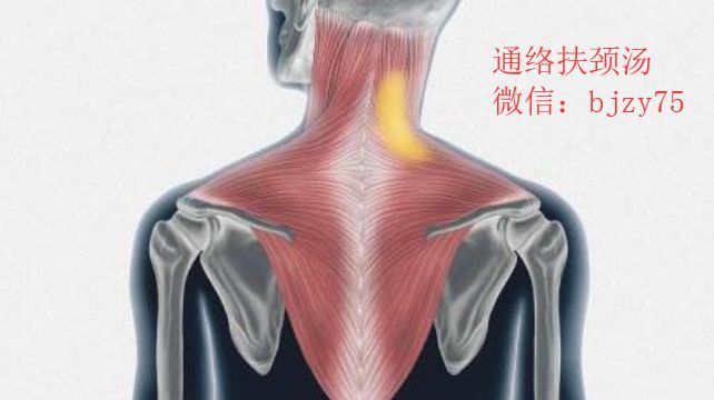 痉挛性斜颈怎么治疗 医生 不同类型 治疗方法不一样 腾讯新闻