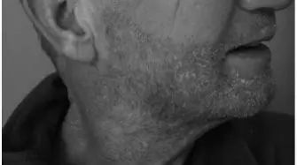 问 头皮屑长到脸上是什么感受 腾讯新闻