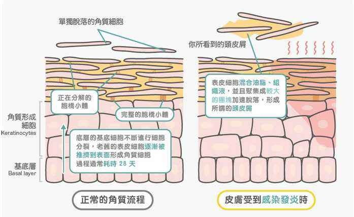 天气干燥头屑纷飞 先弄清头皮屑的真相 腾讯新闻
