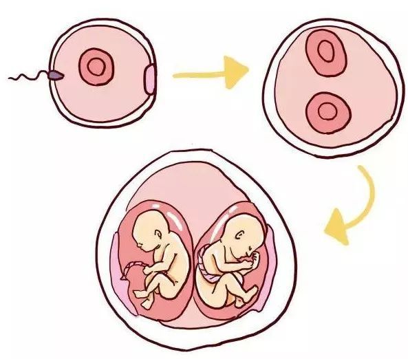 但是根据受精卵在早期发育阶段发生分裂的时间不同,单卵双胎又分为4种