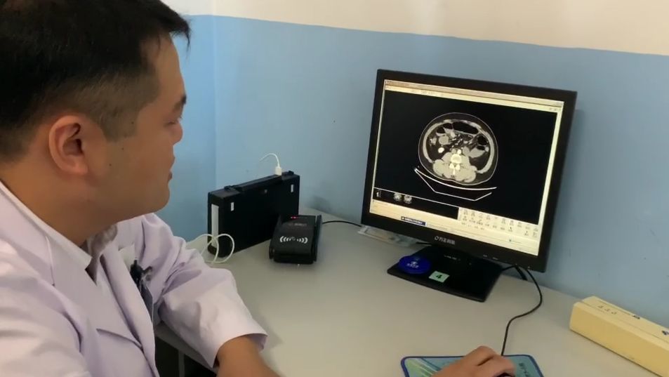 四旬男子饭后突然腹痛,肚大如球!这种罕见疾病,肥胖男性需注意