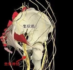 梨状肌炎 腾讯网