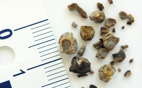 爱心融化了他的前列腺结石,家庭和睦真是一剂万能良药