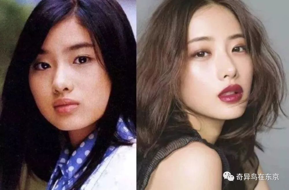 鼻唇沟纹怎么去除,去除鼻唇沟皱纹