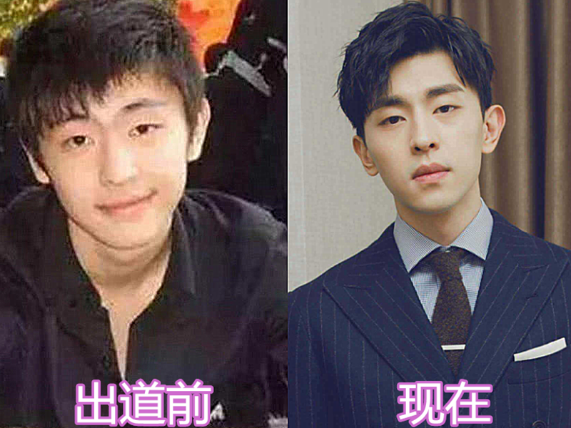 当红男星出道前vs后张艺兴胖嘟嘟邓伦变化大肖战开挂逆袭