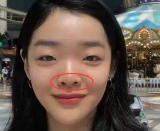 青春期女孩子嫌鼻子丑?学会3招练成"水滴鼻",还怕男神不喜欢?