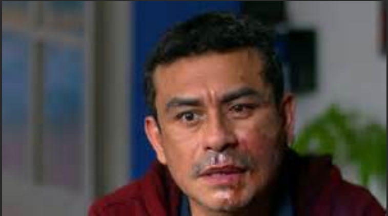 滚回你的祖国,秘鲁移民在美国被当街泼浓酸,