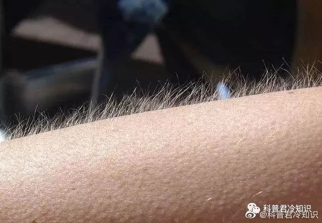 坐月子身体起鸡皮疙瘩(月子里起鸡皮疙瘩算受凉吗)