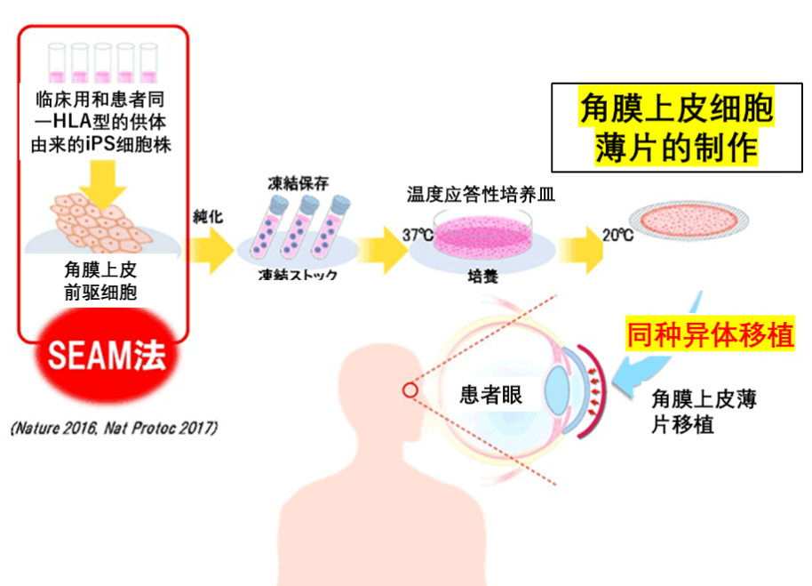 500万人中不足一万人能等到可移植角膜 Ta有望解决供体不足难题 腾讯新闻