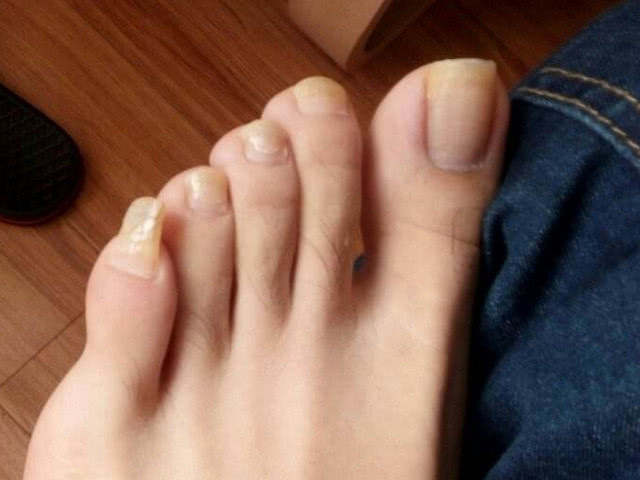 肾不好先看脚 脚上若从没有这3个 症状 那你的肾脏还很健康 腾讯新闻