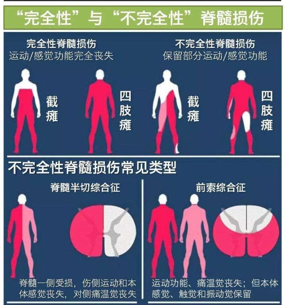 今天咱们来聊聊什么是脊髓损伤 腾讯新闻