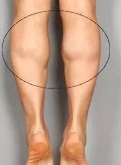 女生小腿肌肉特别结实,怎样才能瘦小腿?