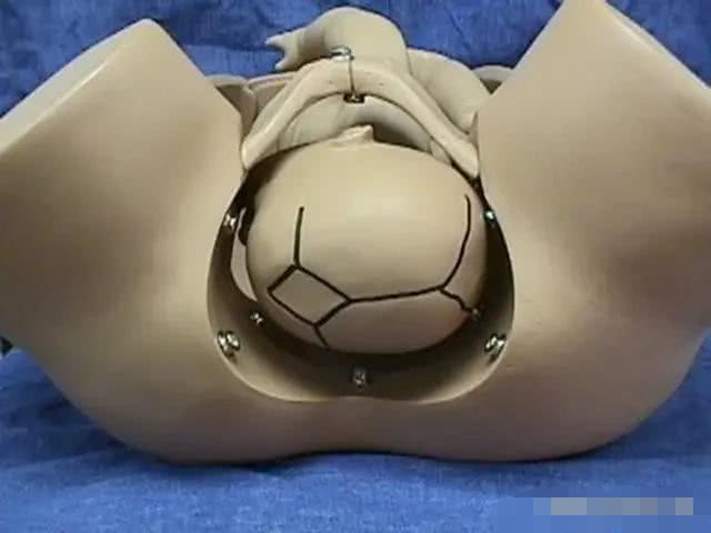 自然分娩是最好的分娩方式吗?说出来你都不一定会信,涨知识了!