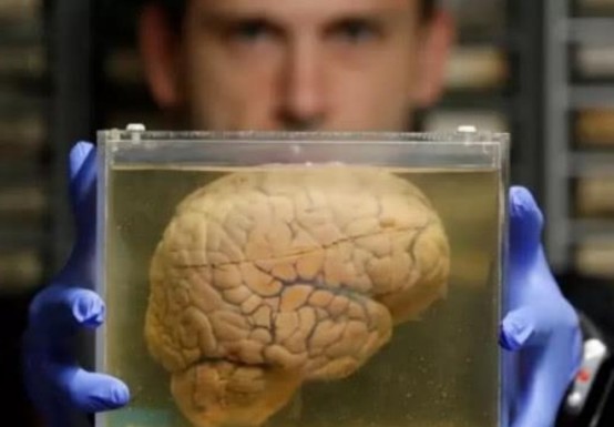 爱因斯坦临死前说了两句话护士没听懂死后大脑被割成240块