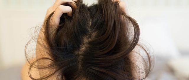 30岁就有白头发 变白后还能变黑吗 牢记这3点 帮你减少白发 腾讯新闻