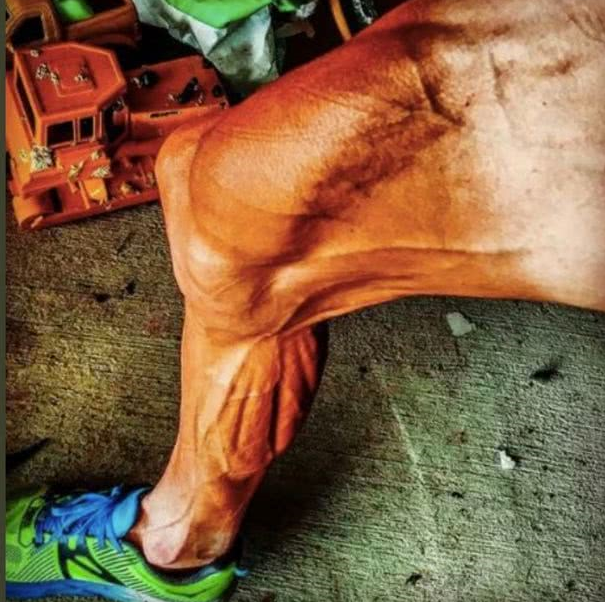 受不了!自行车冠军晒出"小腿肌肉",像极了"僵尸腿",网友直呼不忍直视