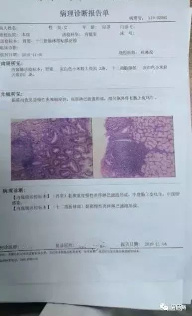 3分钟看懂:胃镜活检病理报告_腾讯新闻