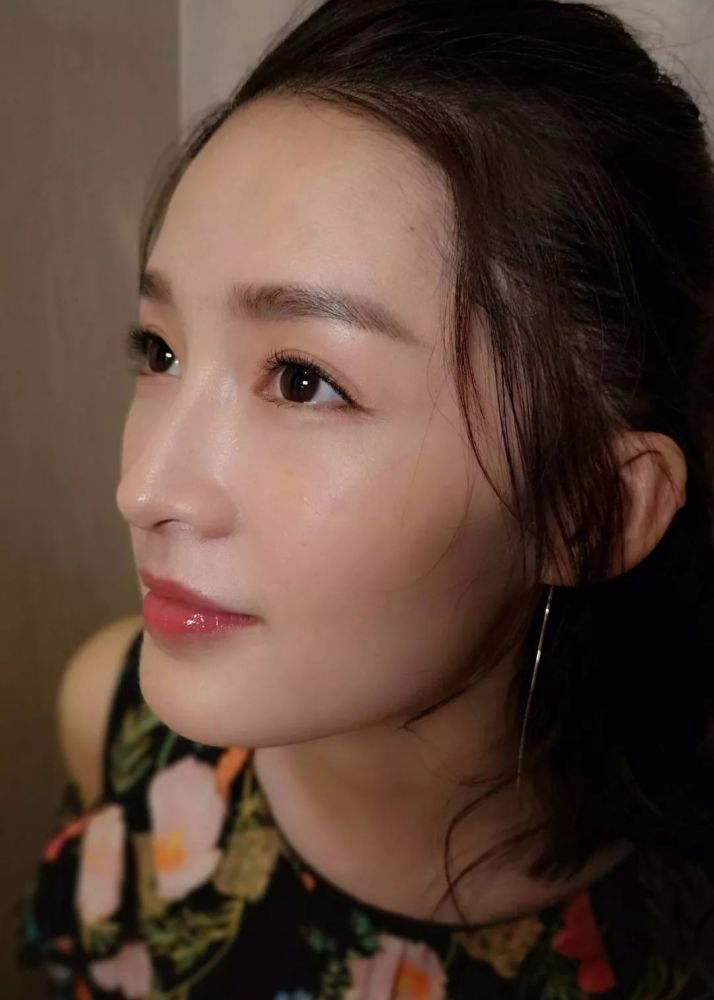 从满脸闭口到最美空姐,李沁对自己的脸做了什么?