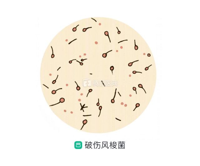 破伤风杆菌芽孢手绘图图片