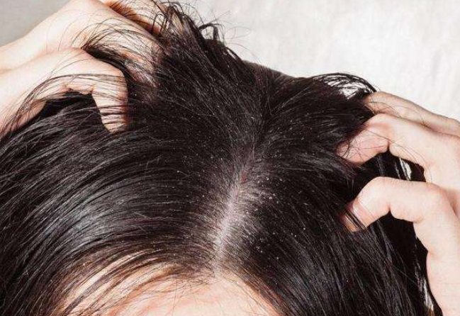 为什么头发越洗越油?90%女生都犯了这"3错误",再不改小心秃顶