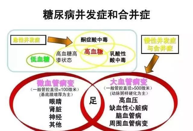 如何逆转甜蜜的杀手 糖尿病 腾讯新闻