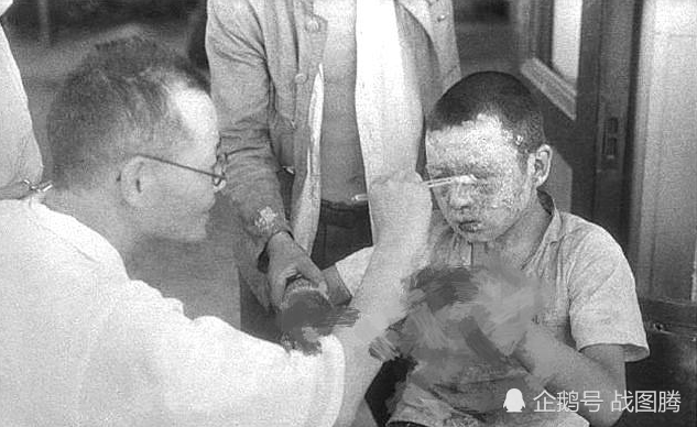 核辐射幸存者不能马上洗澡广岛核爆后大量人因此而死太可怕了