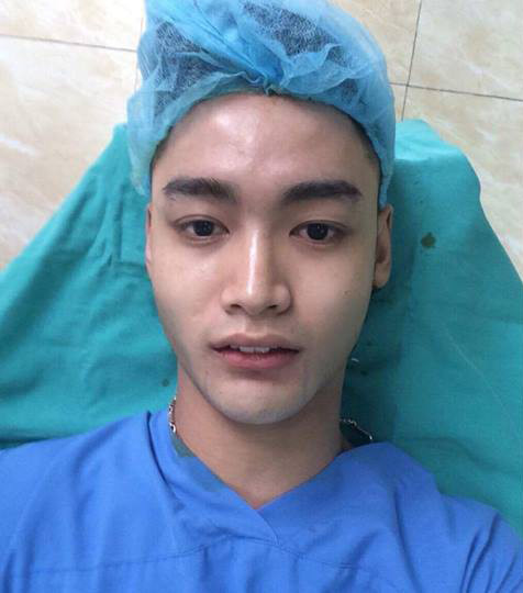 男子因长相自卑整容变帅哥,现自己开多家整容医院还替人做手术