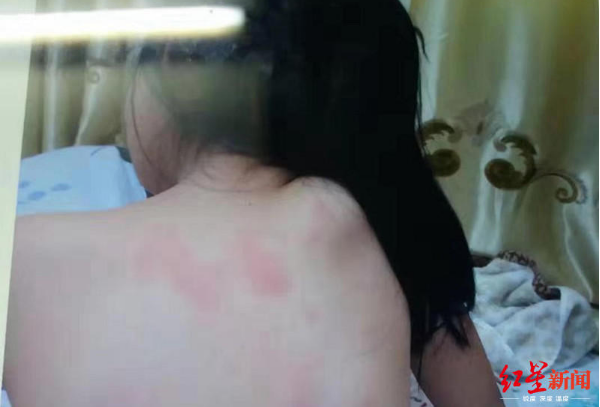 老师打女童致残疾怎么回事 什么仇什么怨竟会下此狠手?