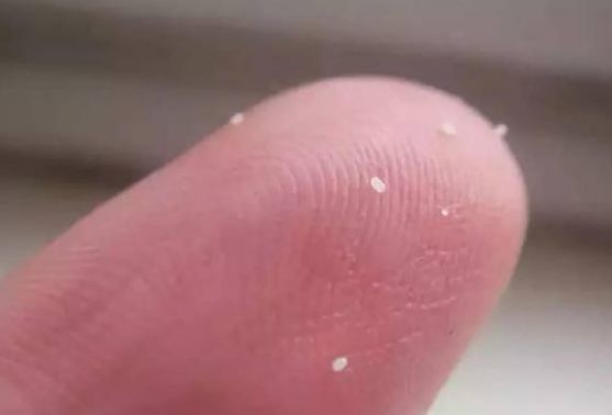 跳蚤虫卵母蚤在这段时间里,吸血次数会降低,每天产卵20~30颗.