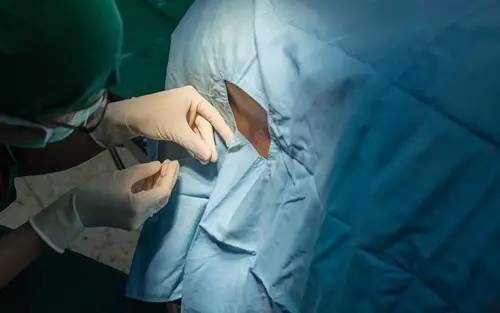 做腰穿会让人变傻吗?一孕傻三年,和它有关吗