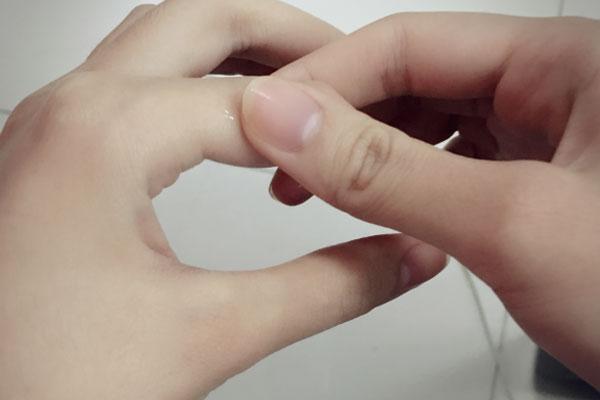 为什么手上会掉皮 和哪些原因有关 避免掉皮加重 如何改善 腾讯新闻