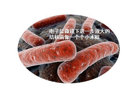 桓世彤全球20亿人携带结核菌我的工作就是拆掉这些定时炸弹