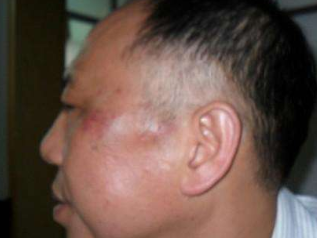 肾脏不好的男生,脸上会有这三个特征,快看看你家男票有么?