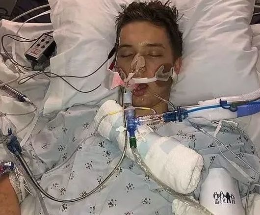 下图中插满管子的少年少女们,都是因为吸电子烟,最后不得不依赖呼吸机