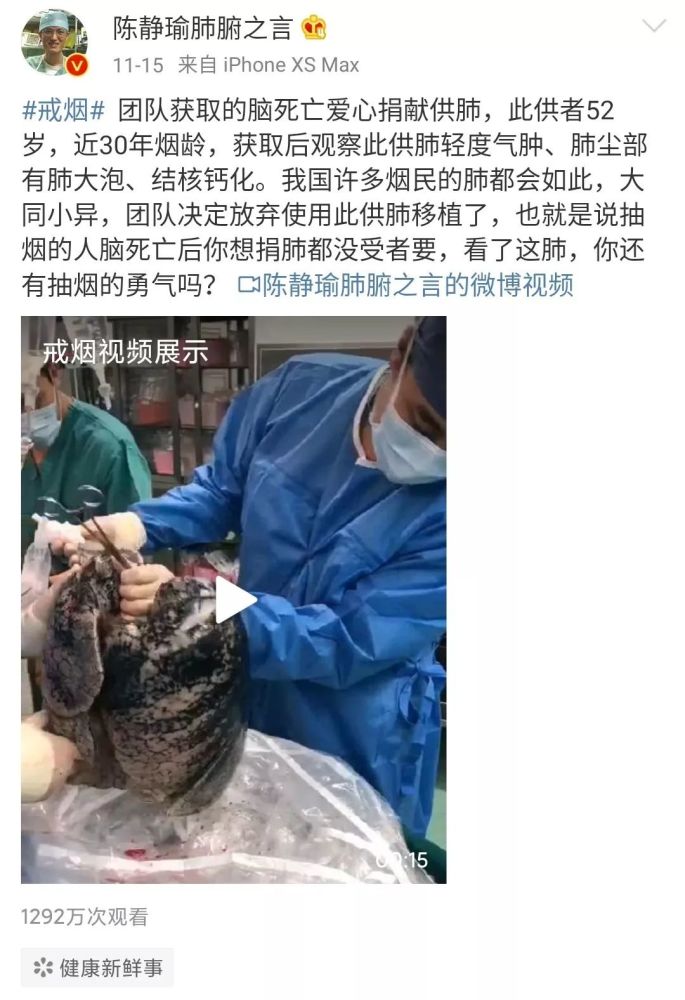 史上最硬核戒烟广告30年烟龄男子捐肺医生取出后不敢用