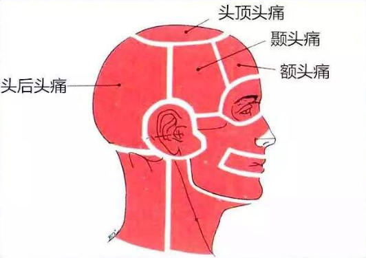 青少年头痛频发 究竟是什么原因 腾讯新闻