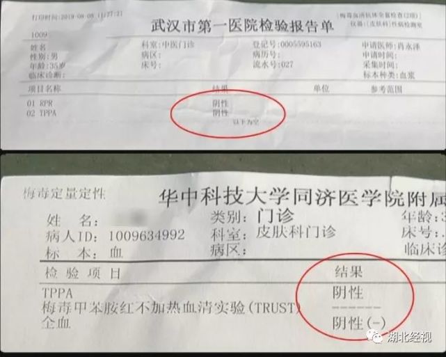 梅毒检查,而这两次的检查结果却与五医院检查报告单上的结果截然不同